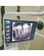 Dentalisches WLAN All-in-One-Intraorale Camera mit 24-Zoll-Touchscreen